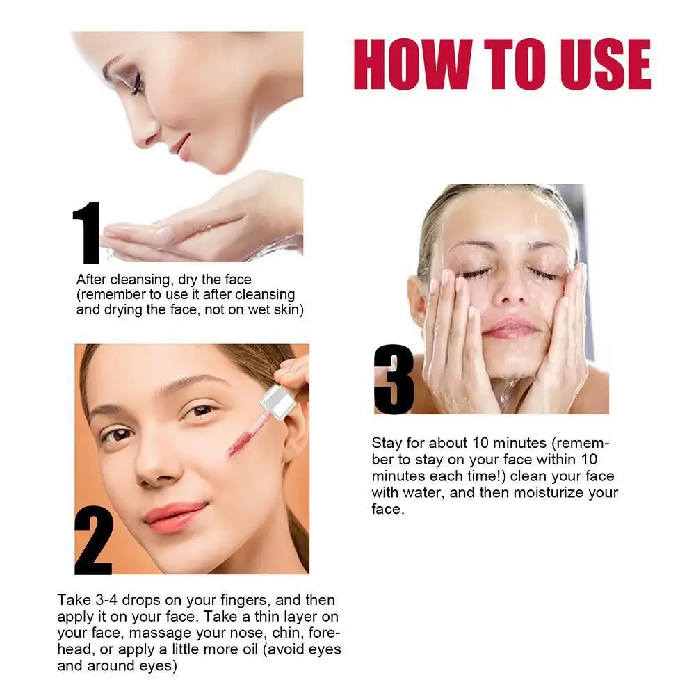 1/2PCS Salicylic Acid Shrink Pores Serum Exfoliating Moisturizing Nourish Smooth Pores Repair Essence For Acne Blackhead & Pores