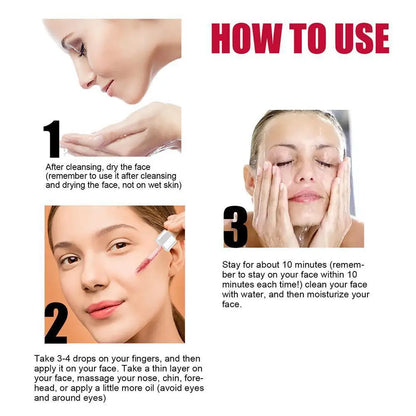 1/2PCS Salicylic Acid Shrink Pores Serum Exfoliating Moisturizing Nourish Smooth Pores Repair Essence For Acne Blackhead & Pores
