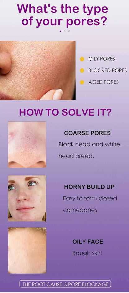 Pore Shrinking Serum Face Removing Large Pores Tightening Repairing Facial Pore Minimizing Essence Skin Care Beauty Firm skin