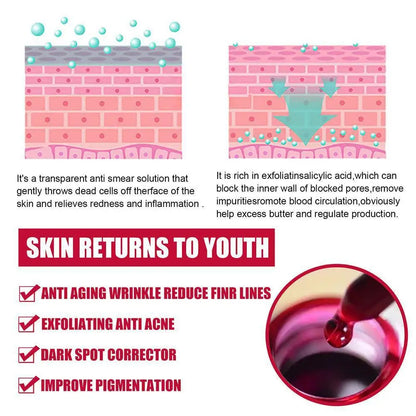 1/2PCS Salicylic Acid Shrink Pores Serum Exfoliating Moisturizing Nourish Smooth Pores Repair Essence For Acne Blackhead & Pores